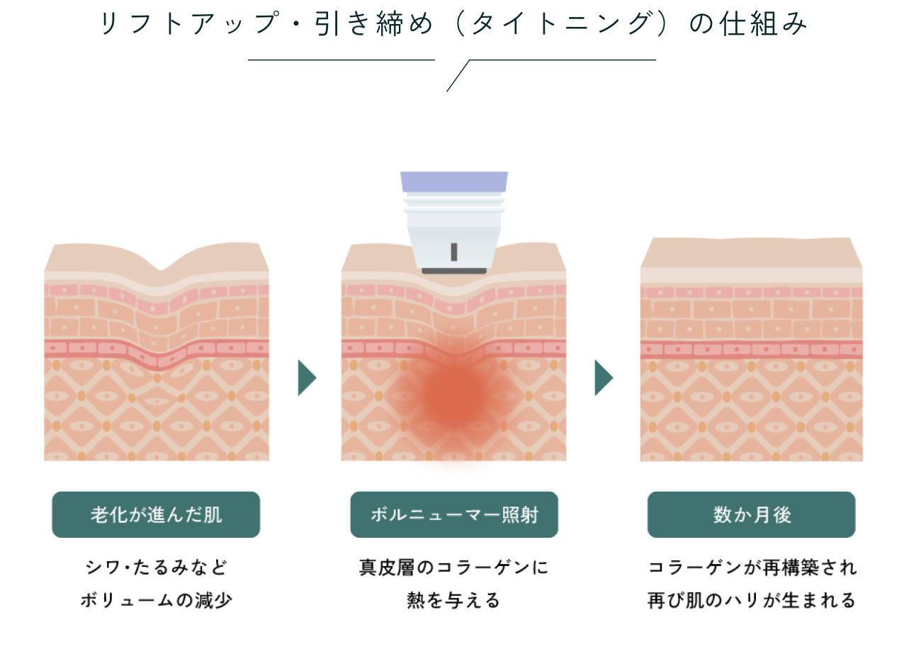 メカニズム図