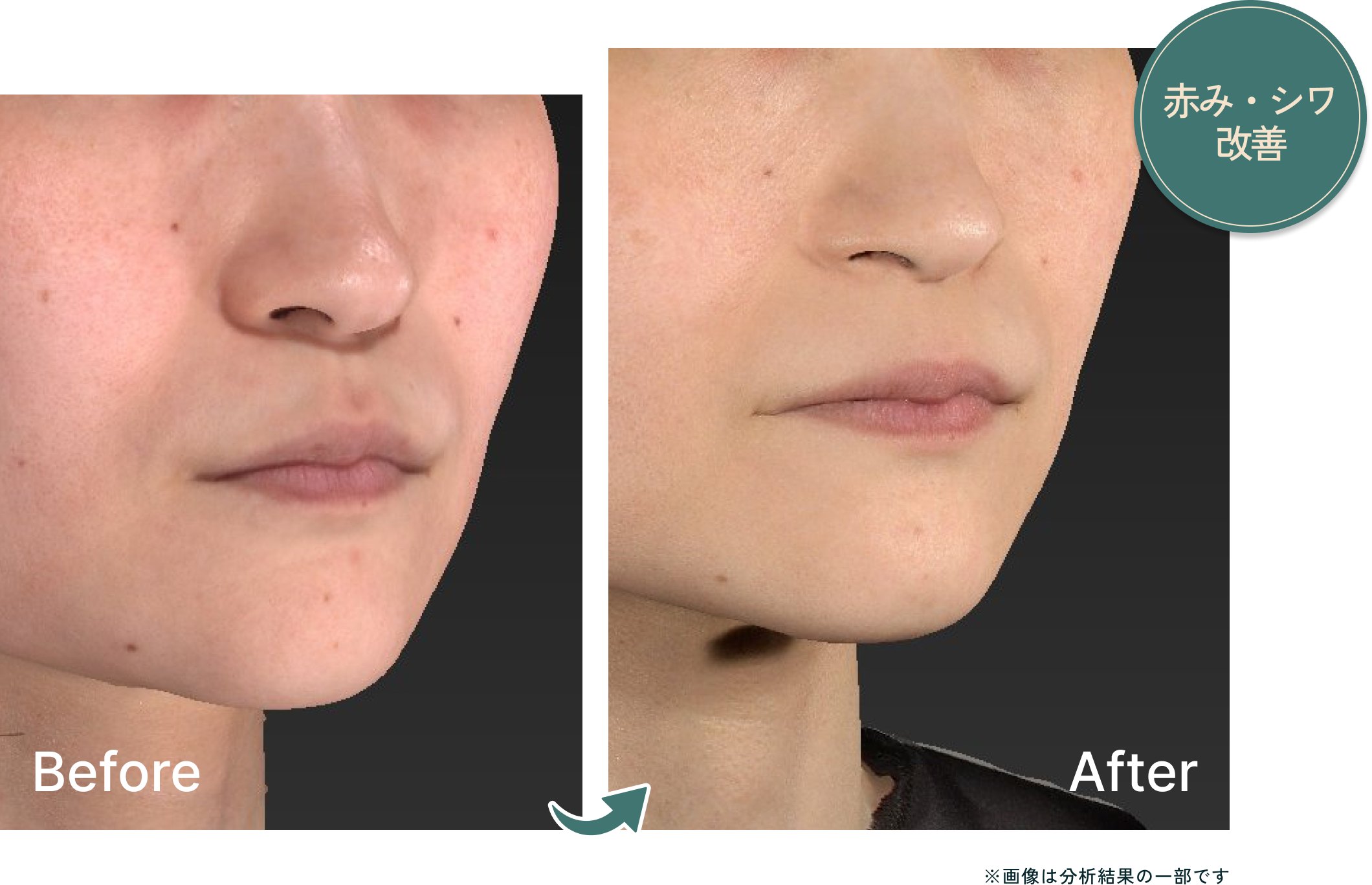 測定結果の変化