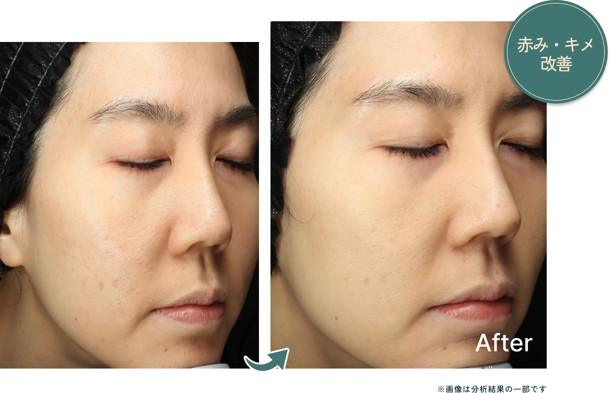 測定結果の変化