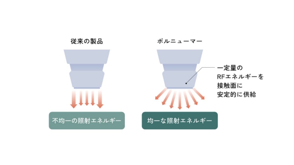 フラクショナル　冷却　RF 高周波　リフト フラクショナル 冷却 RF 高周波 リフト 今回はたるみ治療の